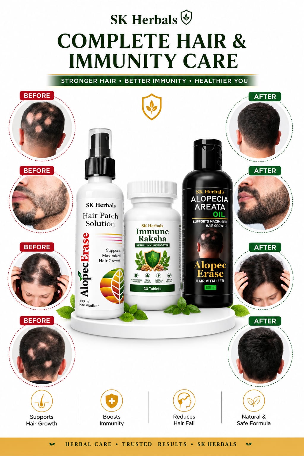 AlopecErase Kit with Immune Raksha Tablets - Image 2
